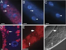 Attēlu rezultāti vaicājumam “Comatricha elegans var. microspora macro”