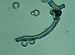 Attēlu rezultāti vaicājumam “Arcyria minuta stalked”