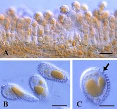 Attēlu rezultāti vaicājumam “Coleosporium sp.”
