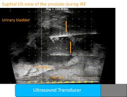 IRE 0.0 IRE 7.5에 대한 이미지 검색결과