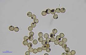 Attēlu rezultāti vaicājumam “Cribraria cancellata var. fusca spores”