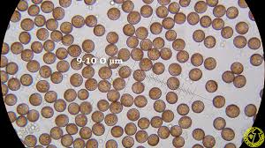 Attēlu rezultāti vaicājumam “Physarum conglomeratum”