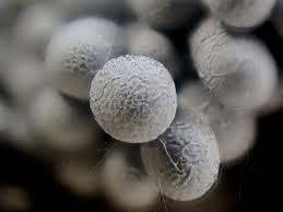 Attēlu rezultāti vaicājumam “Badhamia affinis spores”