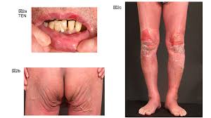 Image result for 向精神薬副作用