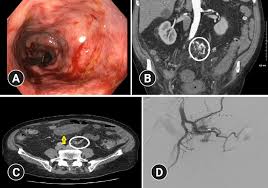 Image result for 뺾