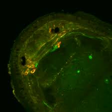 Attēlu rezultāti vaicājumam “Plathelminthes”