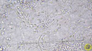 Attēlu rezultāti vaicājumam “Antrodia gossypium”