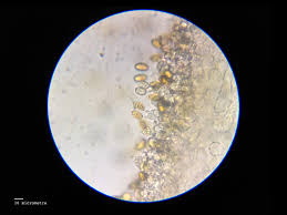 Attēlu rezultāti vaicājumam “Didymium nigripes young”