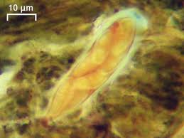 Attēlu rezultāti vaicājumam “Plectocarpon lichenum”
