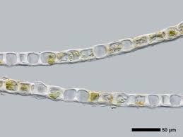 Attēlu rezultāti vaicājumam “Lophozia laxa macro”