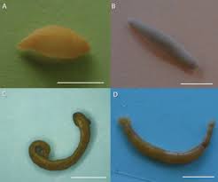 Attēlu rezultāti vaicājumam “Hirudinea”