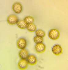 Attēlu rezultāti vaicājumam “Symphytocarpus trechisporus macro”