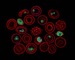 Attēlu rezultāti vaicājumam “Diachea muscorum plasmodium”