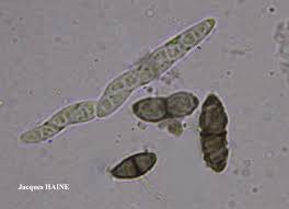 Attēlu rezultāti vaicājumam “Calicium viride”