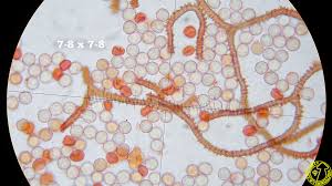 Attēlu rezultāti vaicājumam “Arcyria incarnata”