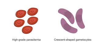 Attēlu rezultāti vaicājumam “Reticularia lobata plasmodium”