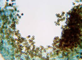 Attēlu rezultāti vaicājumam “Lichenoconium xanthoriae”