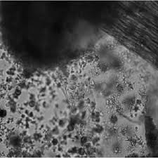 Attēlu rezultāti vaicājumam “Didymium verrucisporum spores”