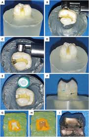 Image result for 뺾