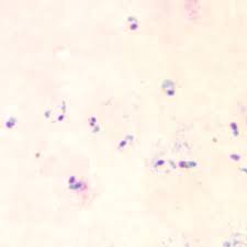 Attēlu rezultāti vaicājumam “Dianema depressum plasmodium”