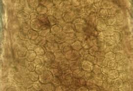 Attēlu rezultāti vaicājumam “Trichia crateriformis spores”