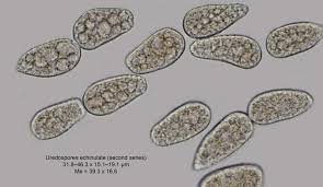 Attēlu rezultāti vaicājumam “Melampsoridium sp.”