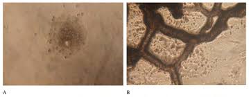 Attēlu rezultāti vaicājumam “Fuligo cinerea spores”