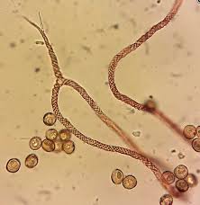 Attēlu rezultāti vaicājumam “Licea chelonoides spores”