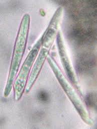 Attēlu rezultāti vaicājumam “Lecanactis abietina”