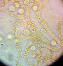 Attēlu rezultāti vaicājumam “Heterotrichia insignis (syn. Arcyria insignis) macro”