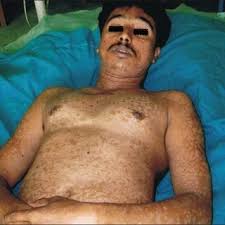 Image result for Lewandowsky-Lutz