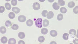 Attēlu rezultāti vaicājumam “Enteridium variabile plasmodium”