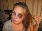 Black Eye | Black Eyed Peas | Black Eyed Peas I Gotta Feeling | I ...