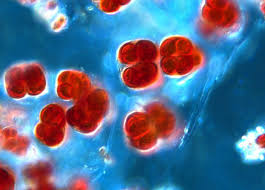 Attēlu rezultāti vaicājumam “Gloeocapsa rupestris”