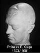 Phineas Gage, life mask, made for Henry Jacob Bigelow in 1849 or 1850. - gage-mask