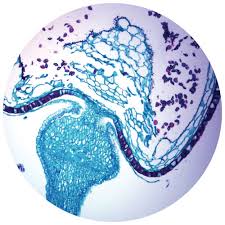 Attēlu rezultāti vaicājumam “Sphagnum sporophyte”