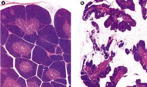 Image result for Thymus