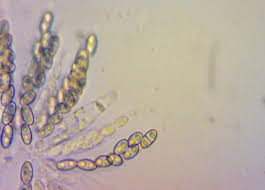 Attēlu rezultāti vaicājumam “Nectria peziza”