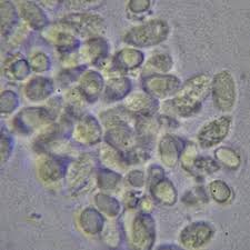 Attēlu rezultāti vaicājumam “Lepista nuda”