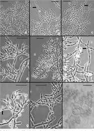 Attēlu rezultāti vaicājumam “Hypocrea rufa”