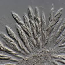 Attēlu rezultāti vaicājumam “Gulielmina vermicularis sessile”