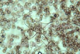 Attēlu rezultāti vaicājumam “Comatricha sp.”