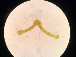 Attēlu rezultāti vaicājumam “Schistidium apocarpum young”