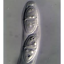 Attēlu rezultāti vaicājumam “Hypocreopsis lichenoides”