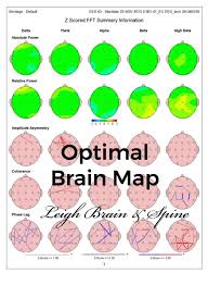 Image result for map of the brain