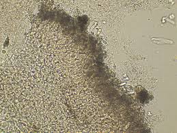 Attēlu rezultāti vaicājumam “Corticium roseum”