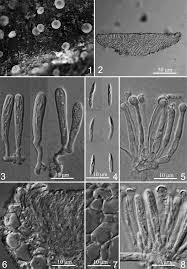 Attēlu rezultāti vaicājumam “Orbilia sp.”