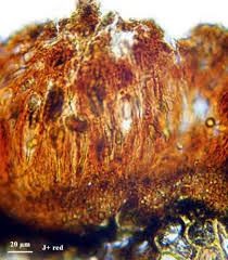 Attēlu rezultāti vaicājumam “Alyxoria varia”