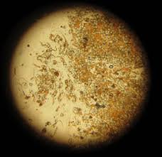 Attēlu rezultāti vaicājumam “Octospora splachnophila spores”