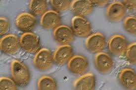 Attēlu rezultāti vaicājumam “Pucciniales”